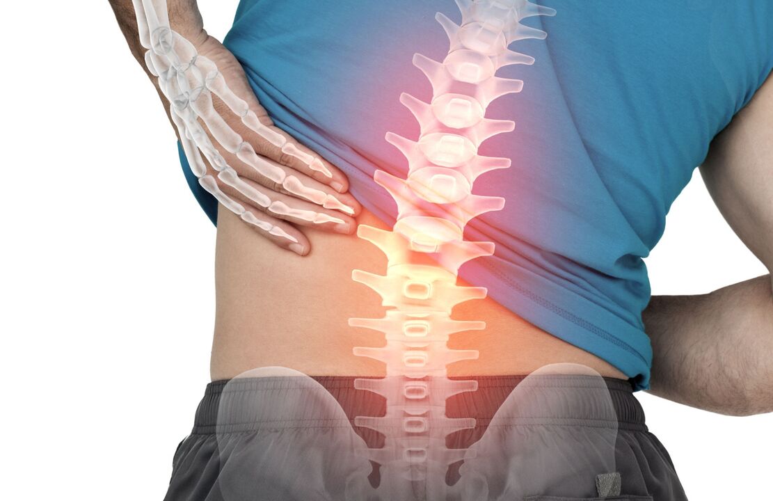O risco de ostecondrose da columna lumbar