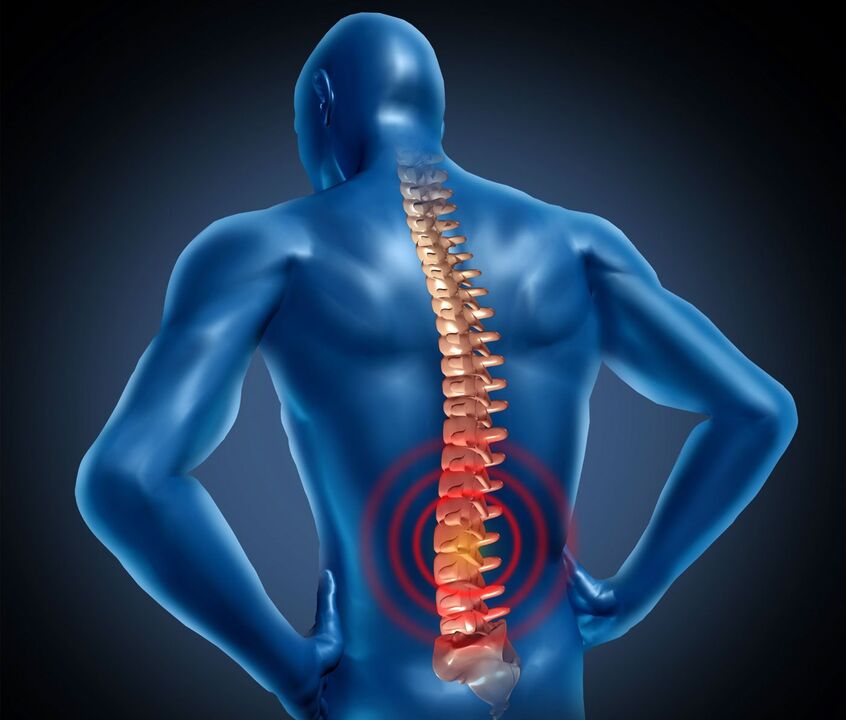 Osteocondrose de Lumbale