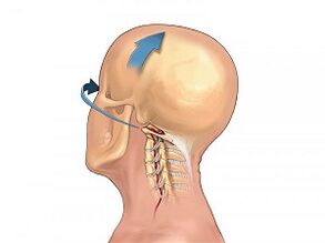 Como a osteocondrose da columna cervical se manifesta