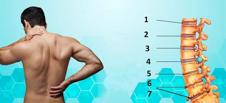 Etapas do desenvolvemento da osteocondrose